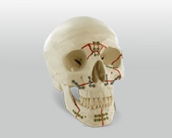 IMPALNTES ORLA MAXILO FACIAL
